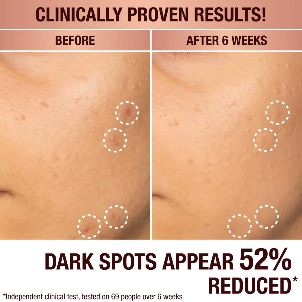 Charlotte Tilbury Dark Spot Correcting Radiance Recovery Serum *Pre-Order*