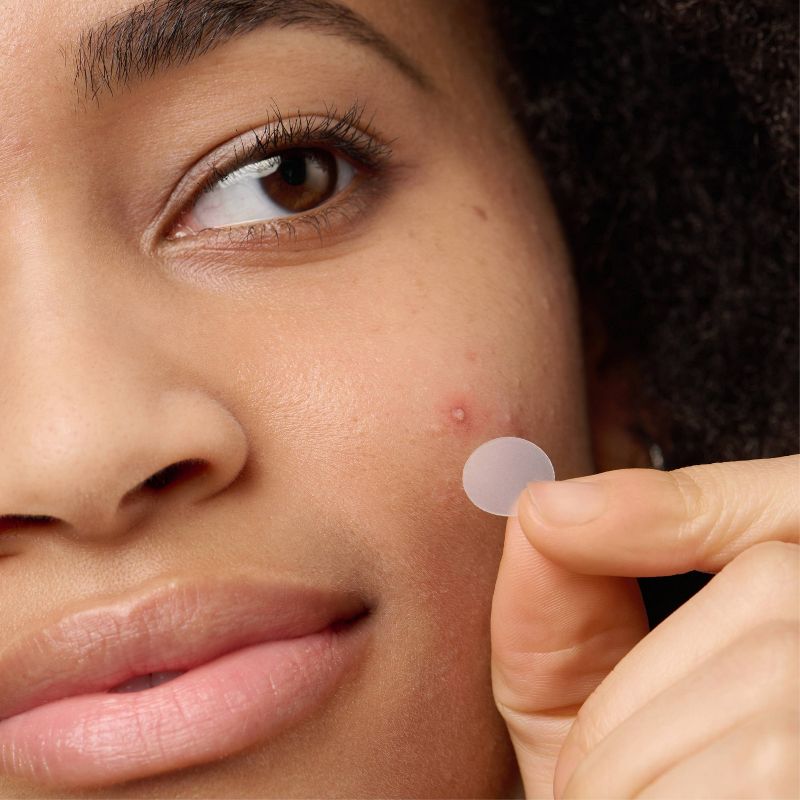 Original Acne Pimple Patches *Pre-Order*
