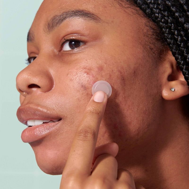 Acne Pimple Patch Micropoint For Blemishes *Pre-Order*
