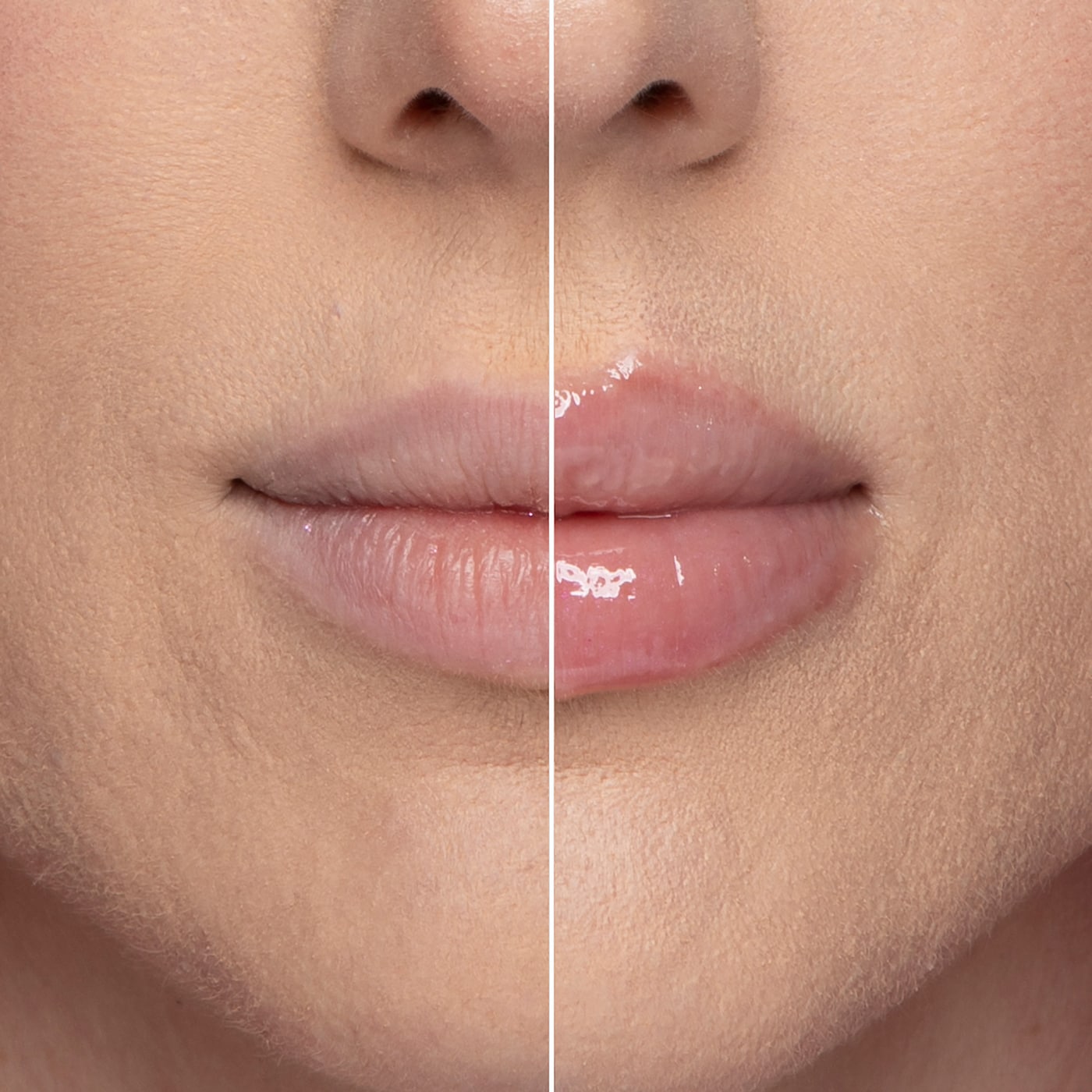 Lip Plumper