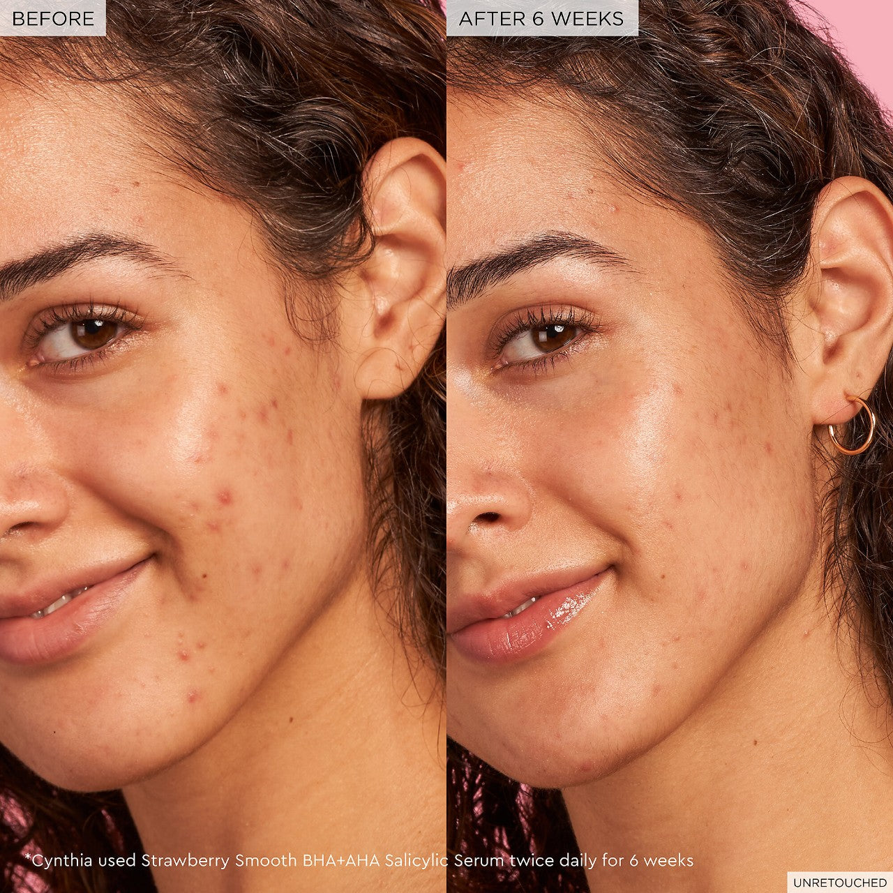 Strawberry Smooth Bha + Aha Salicylic Acid Serum *Pre-Order*