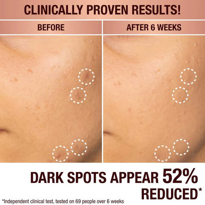 Charlotte Tilbury Dark Spot Correcting Radiance Recovery Serum *Pre-Order*